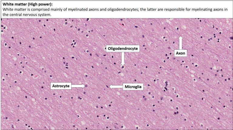 Brain – Cerebrum – NUS Pathweb :: NUS Pathweb