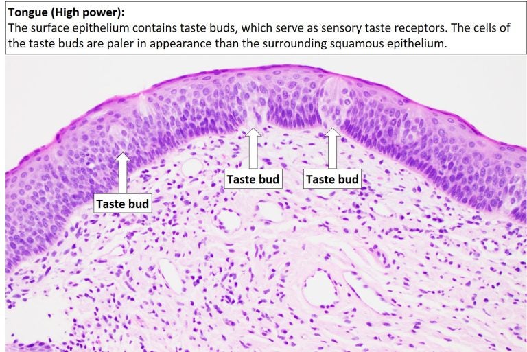 Tongue – Normal Histology – NUS Pathweb :: NUS Pathweb