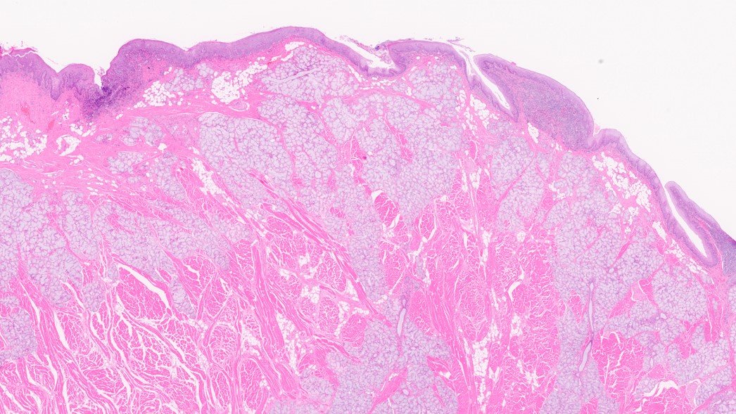 Tongue – Normal Histology – NUS Pathweb :: NUS Pathweb