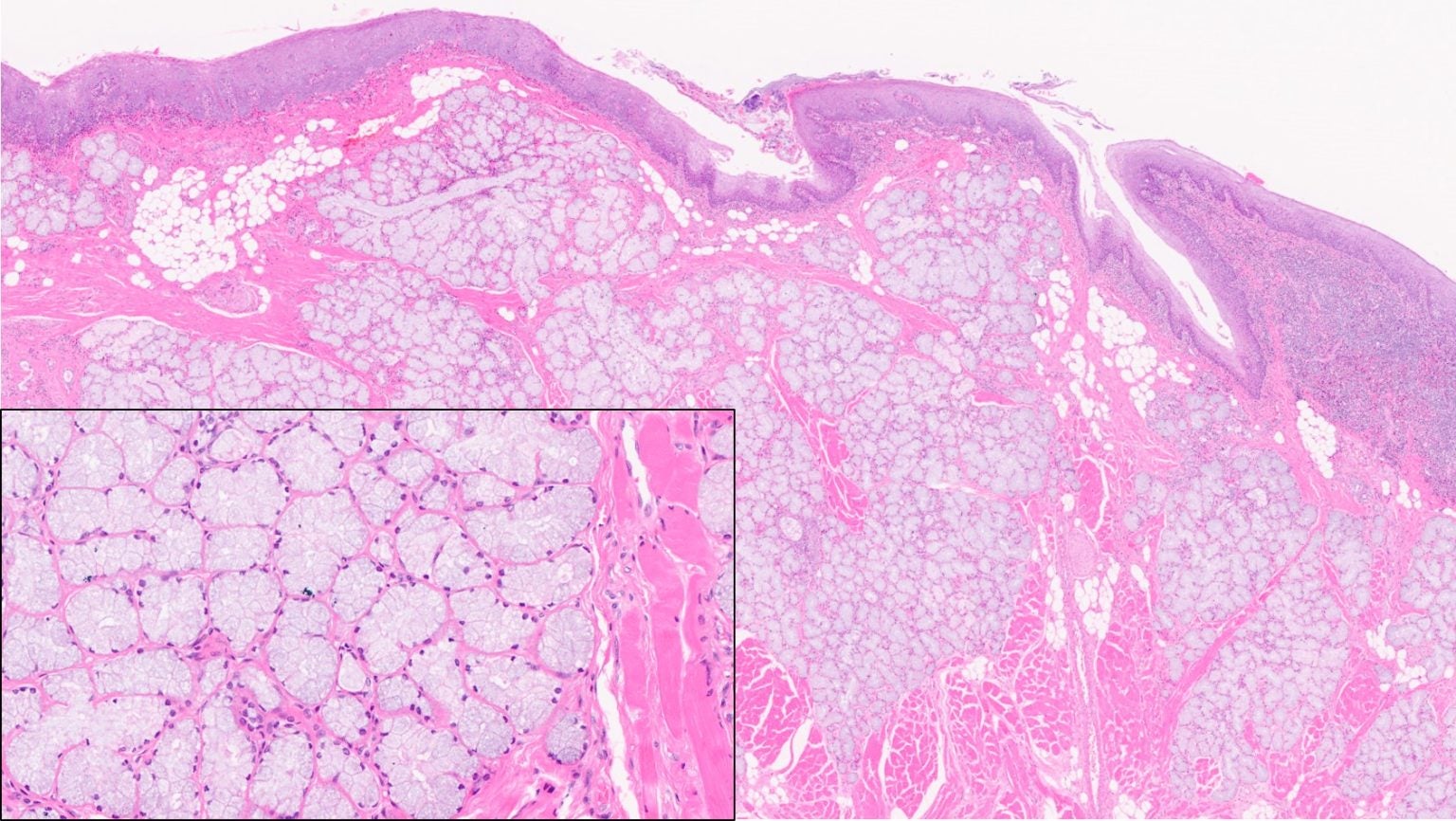 Tongue – Normal Histology – NUS Pathweb :: NUS Pathweb