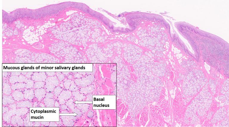 Tongue – Normal Histology – NUS Pathweb :: NUS Pathweb