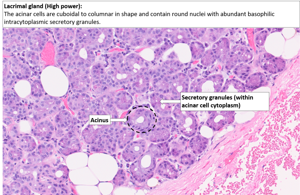 Orbit – Lacrimal gland – NUS Pathweb :: NUS Pathweb