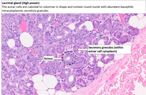 Orbit – Lacrimal gland – NUS Pathweb :: NUS Pathweb