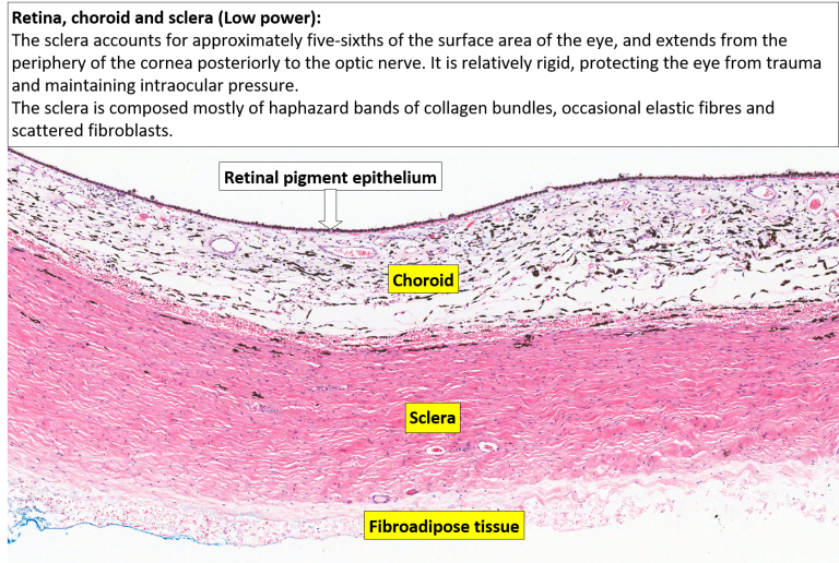 Eye – Retina, Choroid And Sclera – NUS Pathweb :: NUS Pathweb