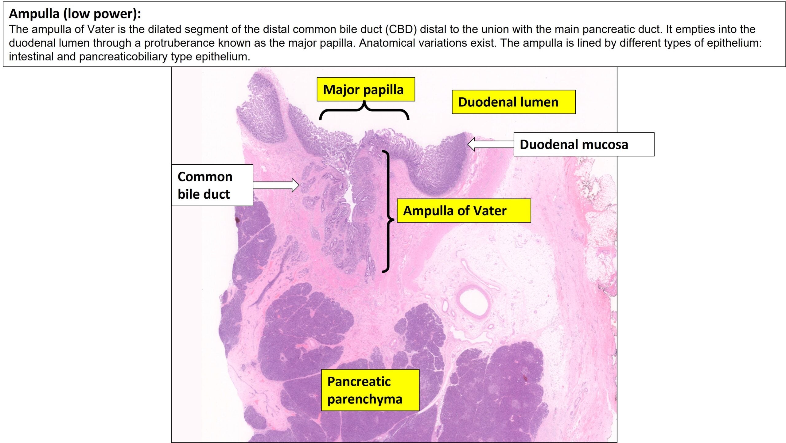 Ampulla Normal Histology NUS Pathweb NUS Pathweb