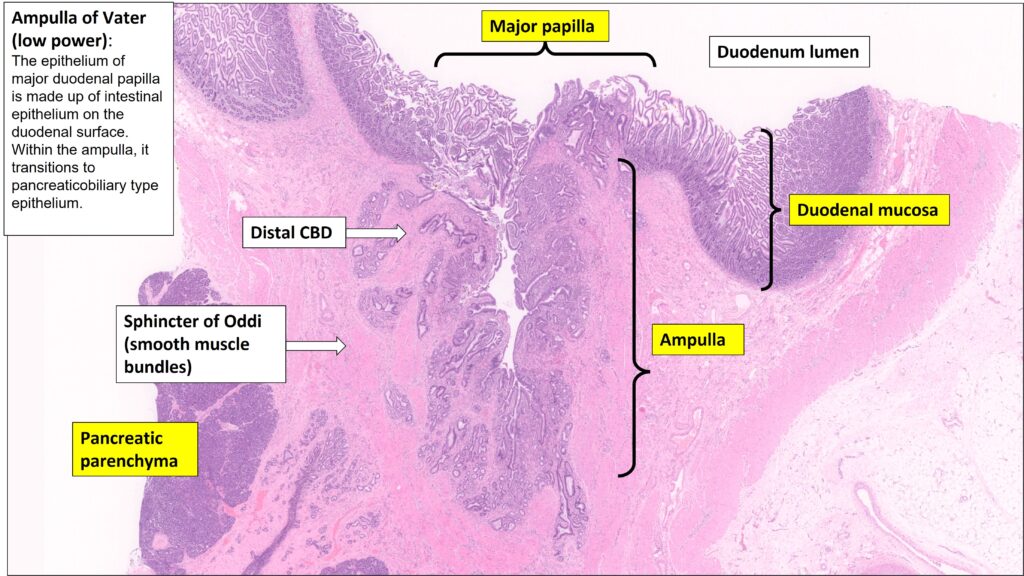 Ampulla – Normal Histology – NUS Pathweb :: NUS Pathweb