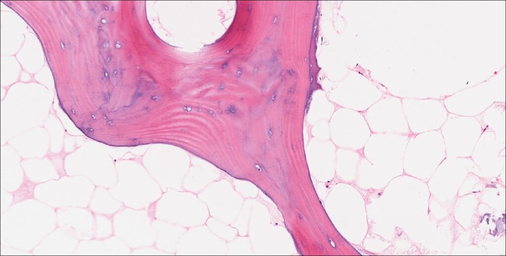 Bone Normal Histology Nus Pathweb Nus Pathweb