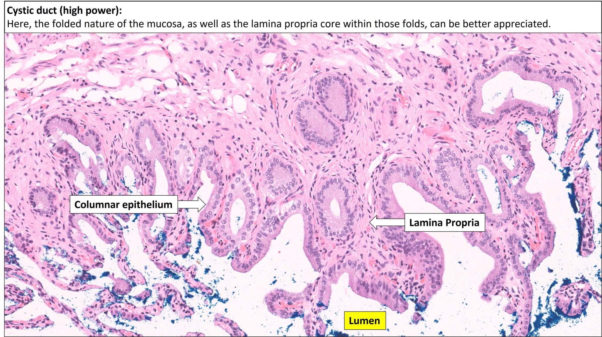 Gallbladder – Normal Histology – NUS Pathweb :: NUS Pathweb