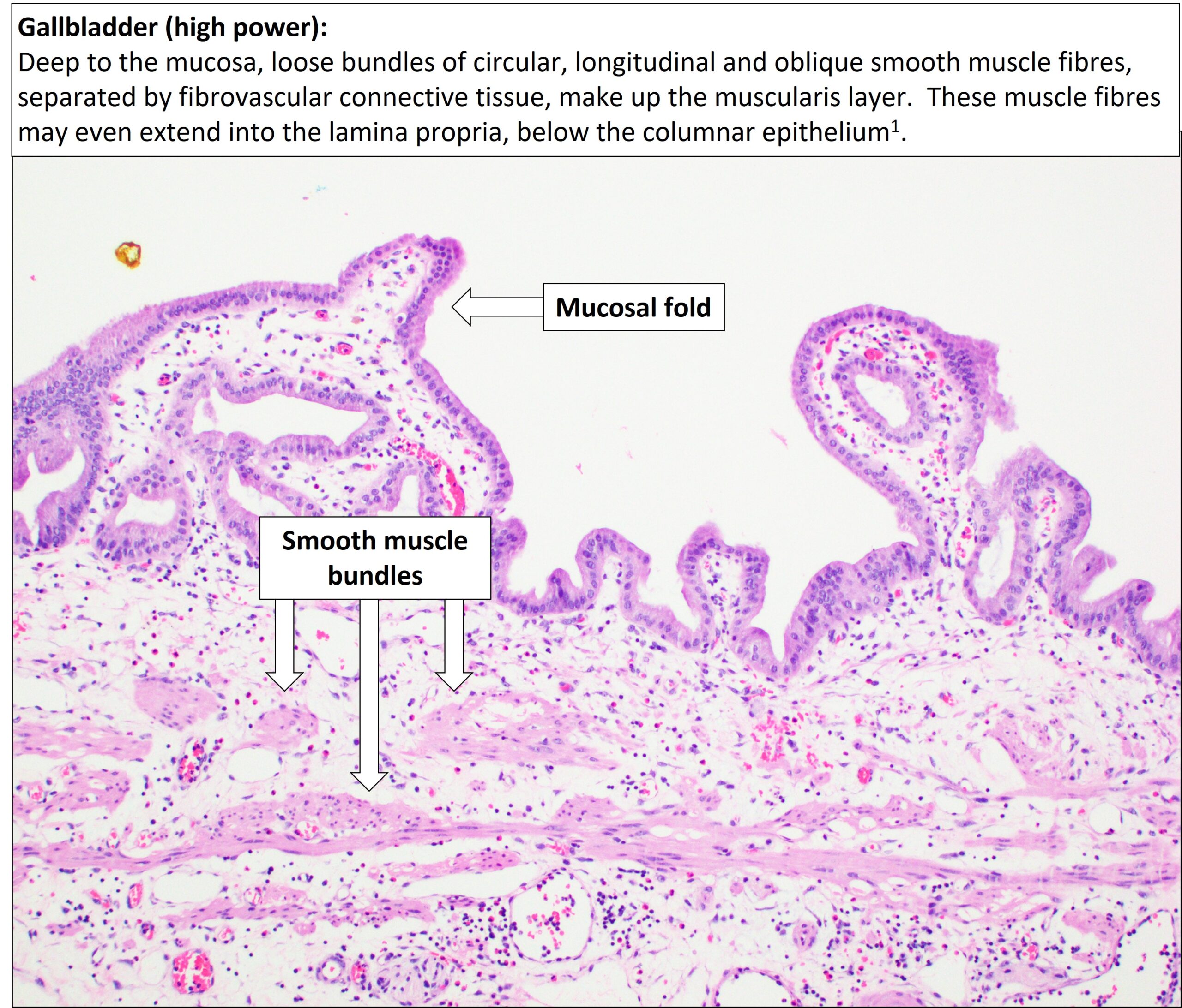 Gallbladder – Normal Histology – NUS Pathweb :: NUS Pathweb