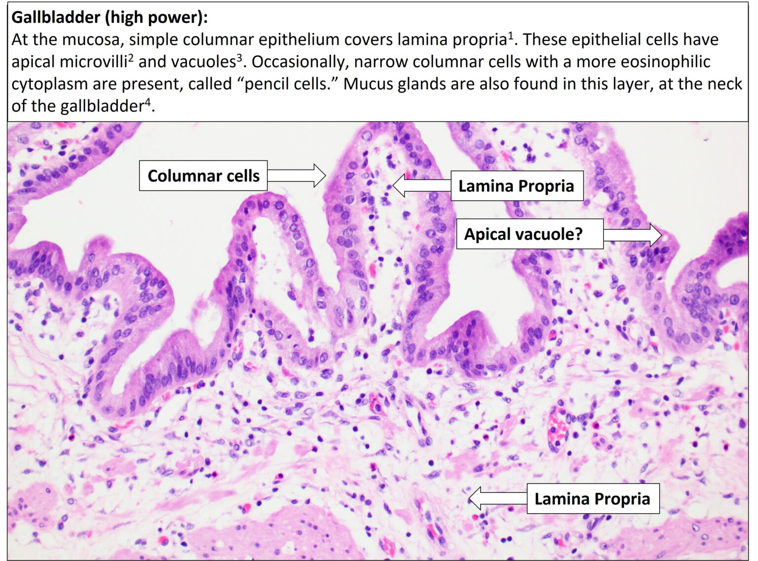 Gallbladder – Normal Histology – NUS Pathweb :: NUS Pathweb