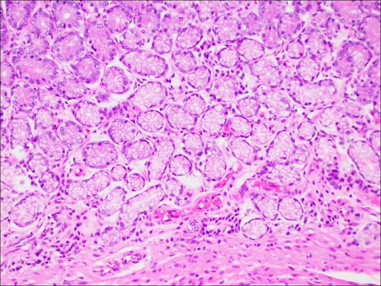 Stomach – Normal Histology – NUS Pathweb :: NUS Pathweb