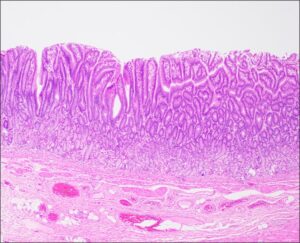 Stomach – Normal Histology – Nus Pathweb :: Nus Pathweb