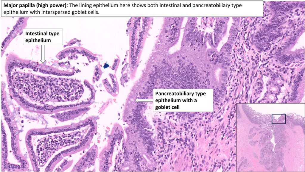 Ampulla – Normal Histology – NUS Pathweb :: NUS Pathweb