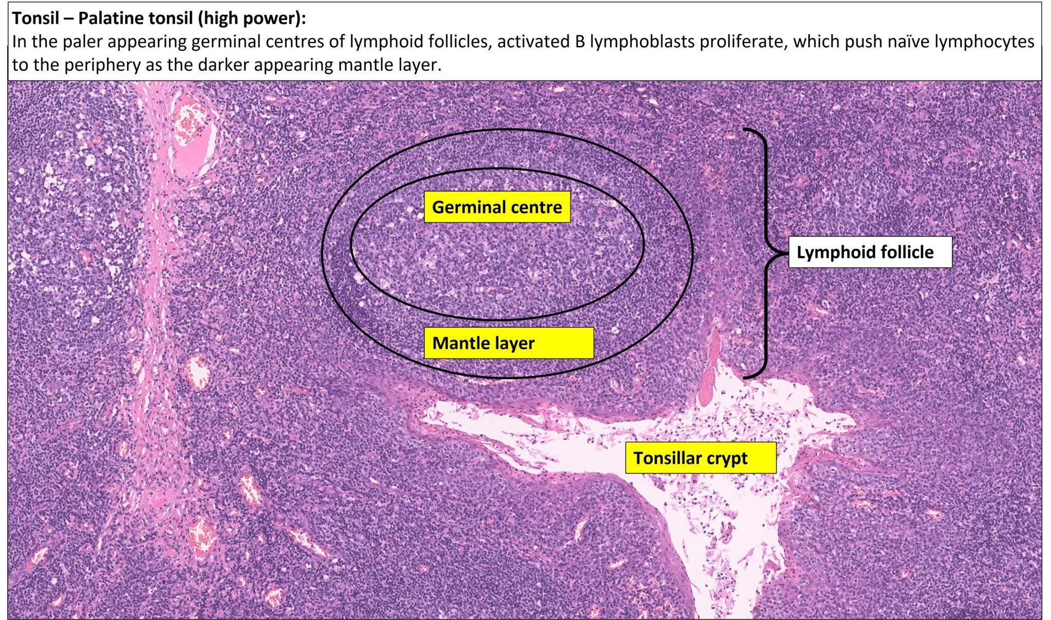 Tonsil Normal Histology NUS Pathweb NUS Pathweb