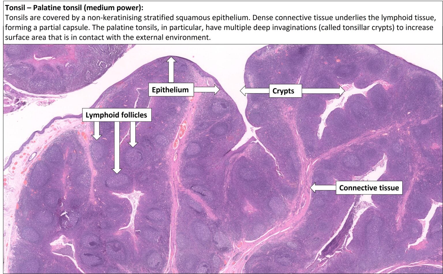 Tonsil Normal Histology NUS Pathweb NUS Pathweb