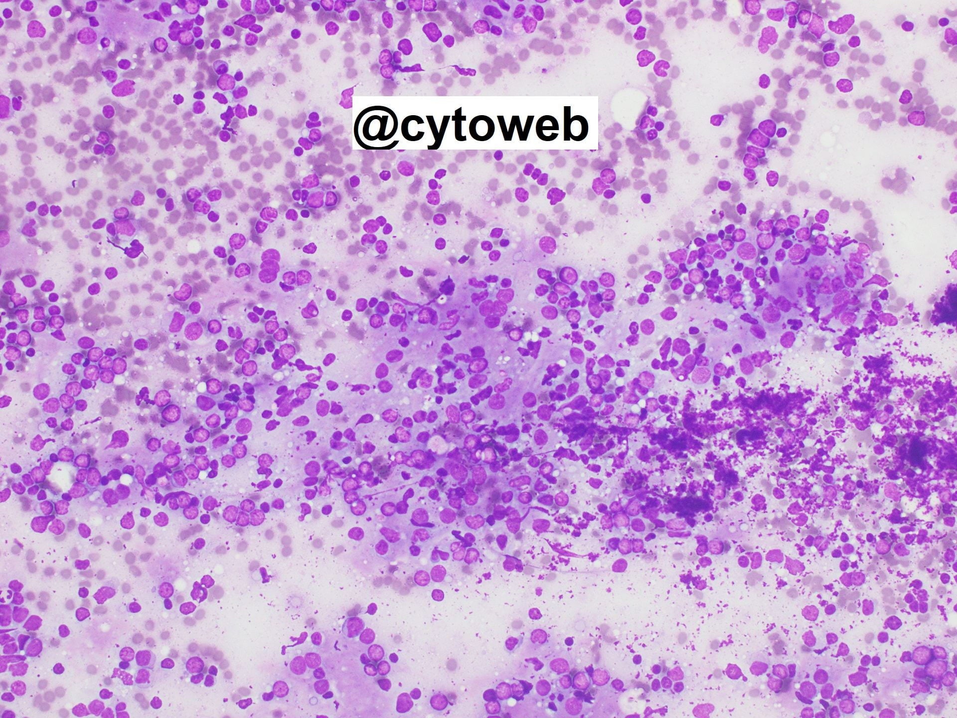 Lymph node case 1