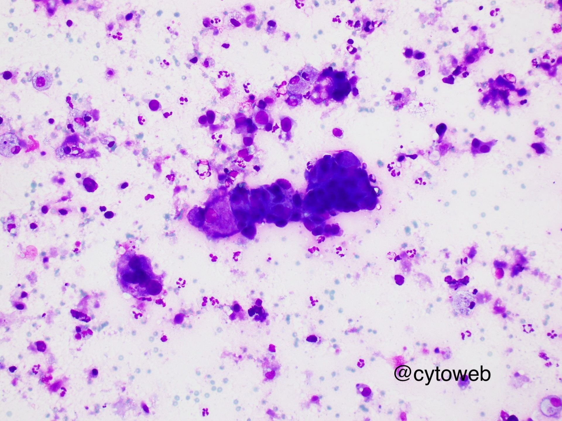 Salivary gland case 1