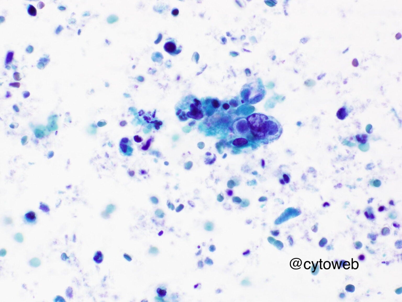 Mystery cases – Salivary gland 1 – NUS Pathweb :: NUS Pathweb