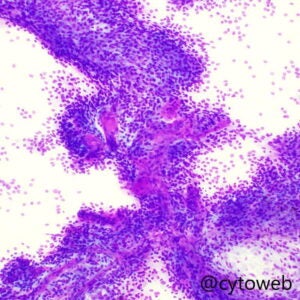 Central Nervous System case 1
