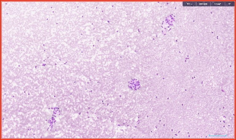 Figure 1: Papanicolaou stain 10x