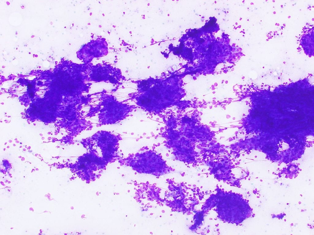 Figure 1: Hemacolor 10x