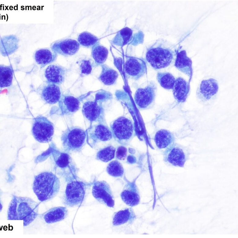 thoracic.3