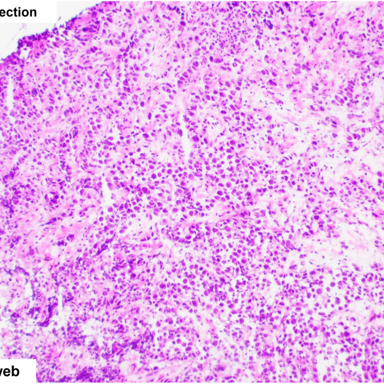 thoracic.4