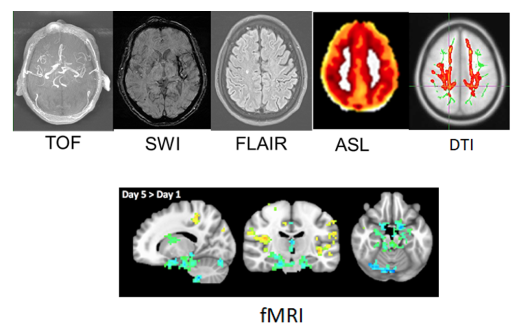 Multimodal Brain Imaging Analysis - NUS - TMR