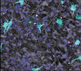 Human stem cell derived microglia co-cultured with neurons