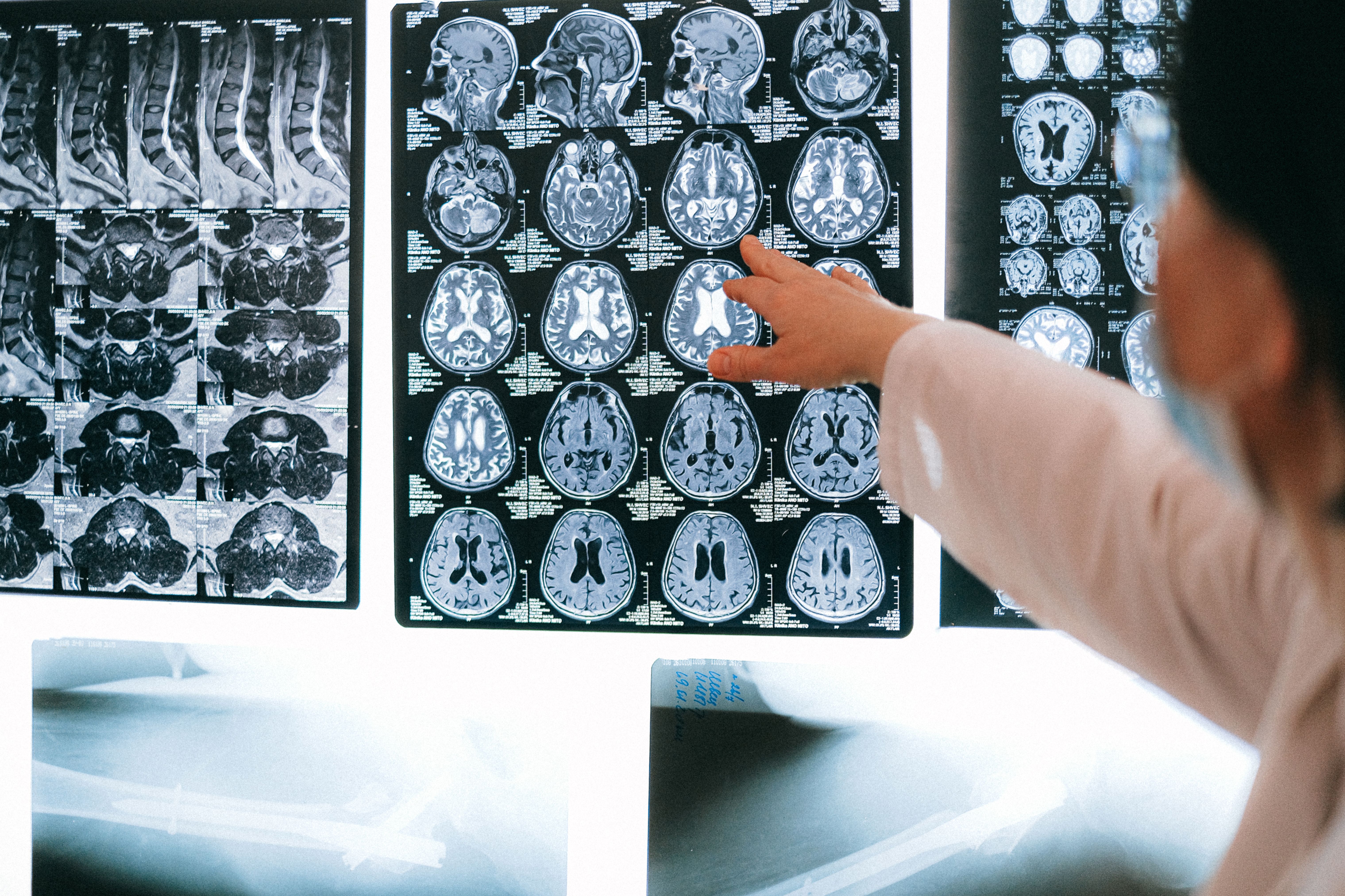 brain imaging