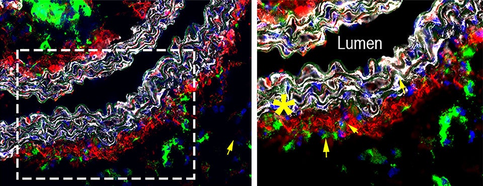 newsinfomain2 macrophage 180815