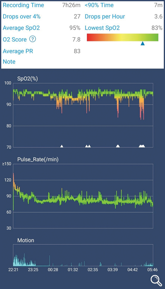 Insert image - Data collected with O2Ring from overnight sleep