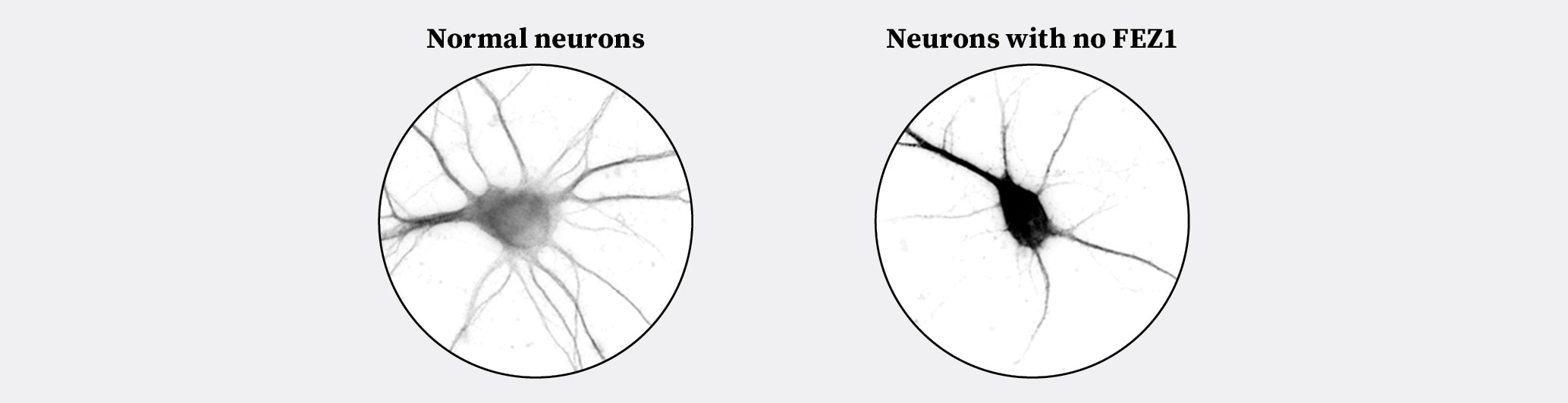 Insert Image - Figure 2 - Neuronal networks
