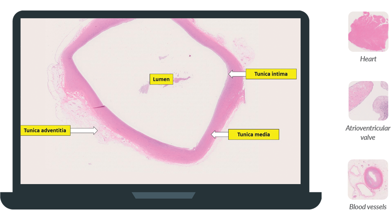 Laptop showing aorta and histology of cardiovascular system