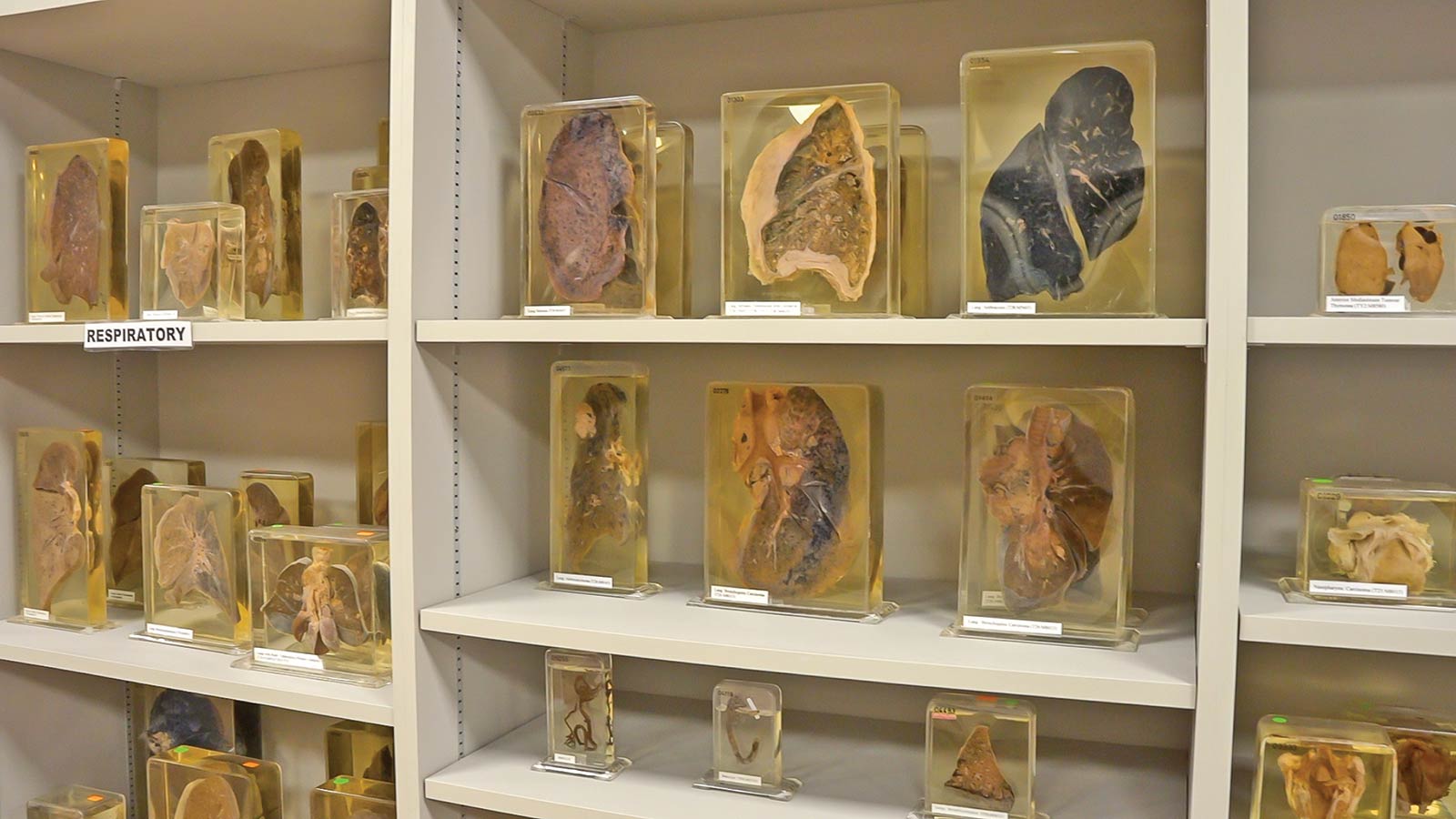 Specimens which are digitised and uploaded onto Pathweb.