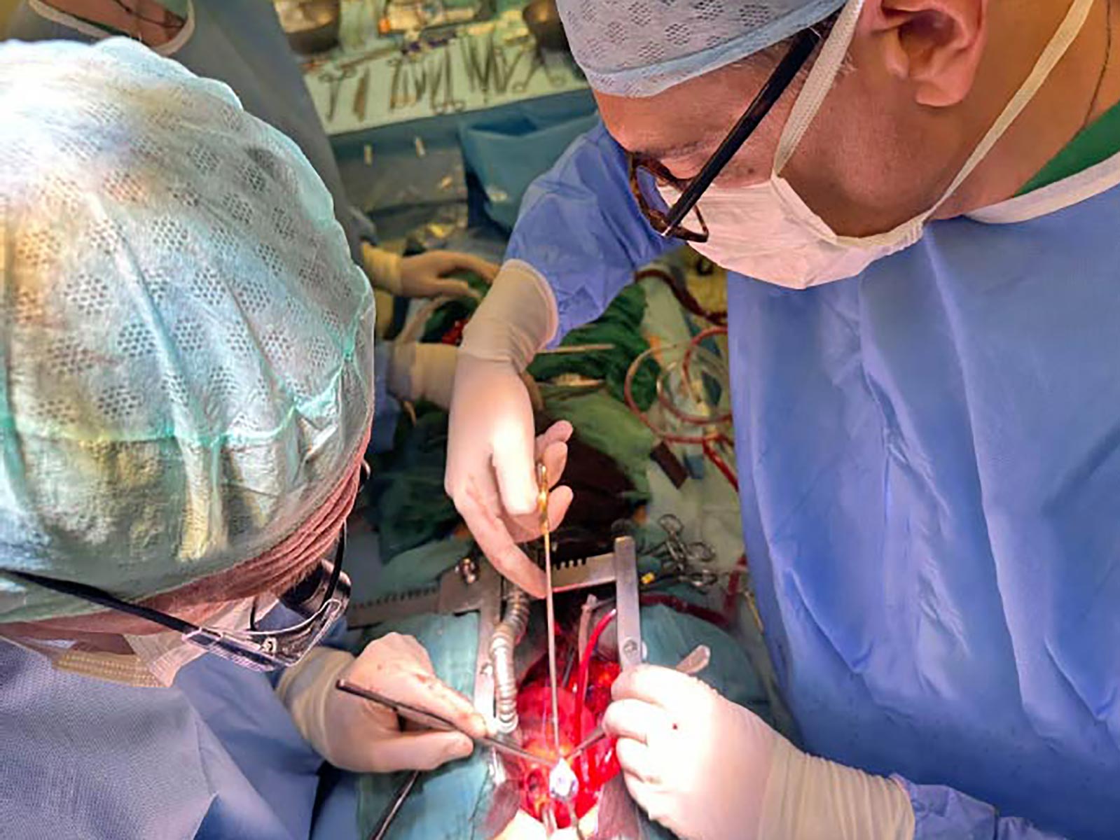 Prof Theo Kofidis performing heart valve repair at the Monzino Heart Institute in Milan, Italy.