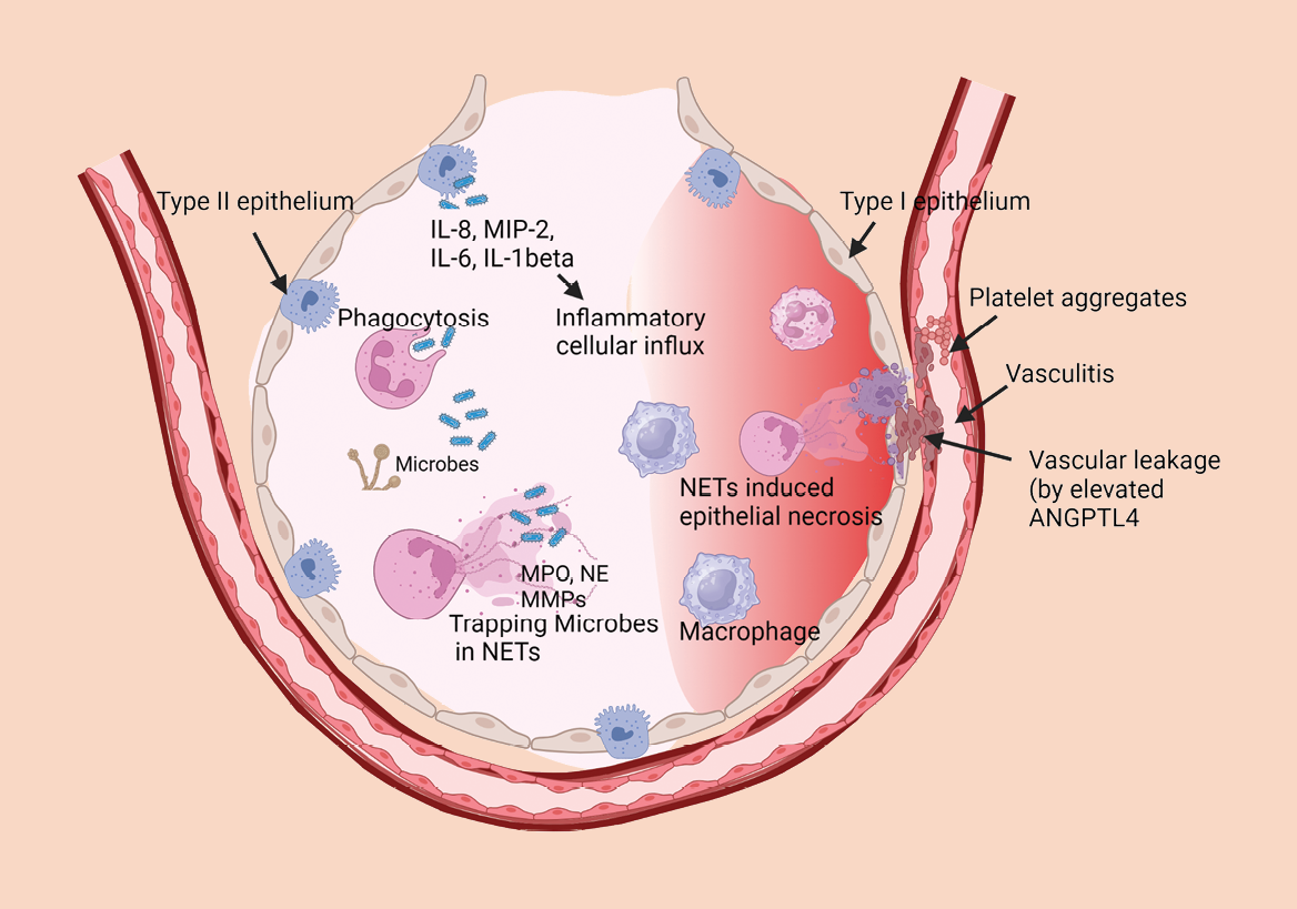 Scientific diagram of Neutrophils and neutrophil extracellular traps (NETs) in pneumonia.