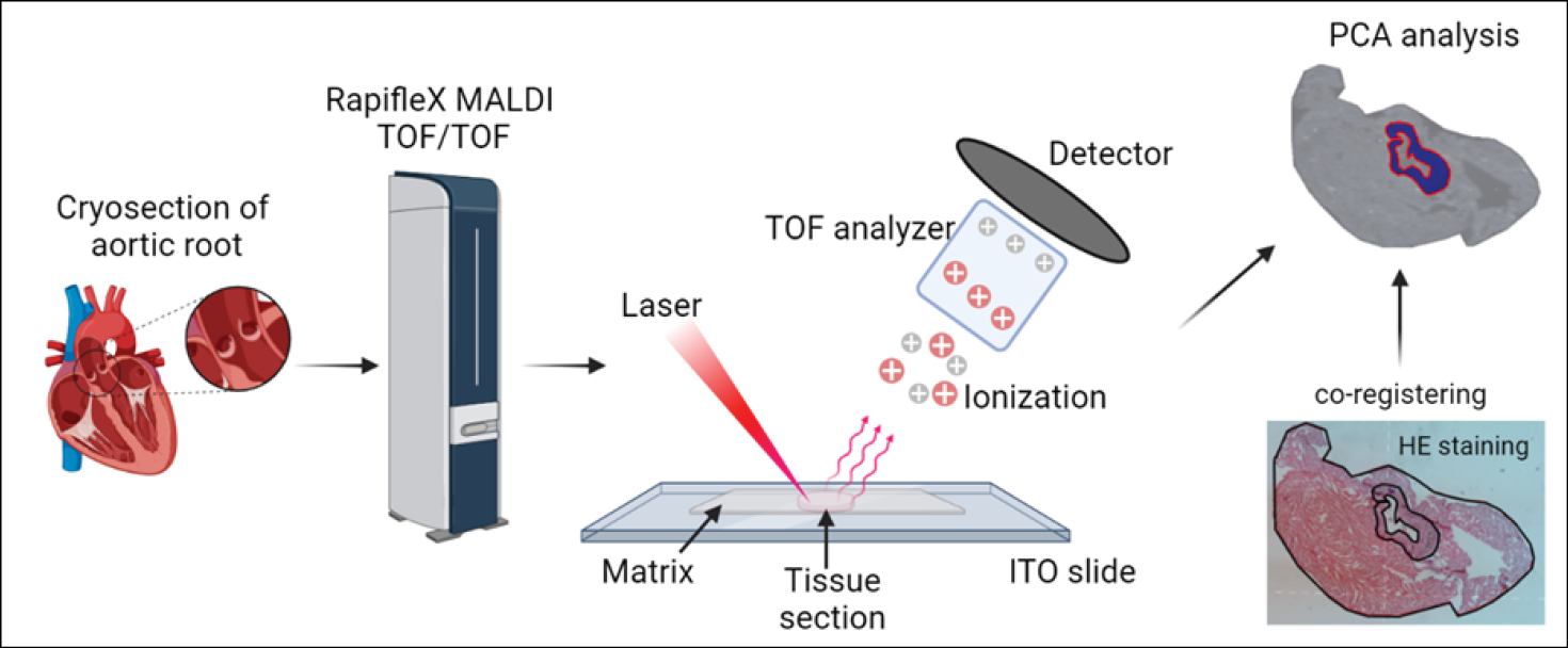 An illustration of mass spectrometry imaging (MSI) on atherosclerotic plaques.