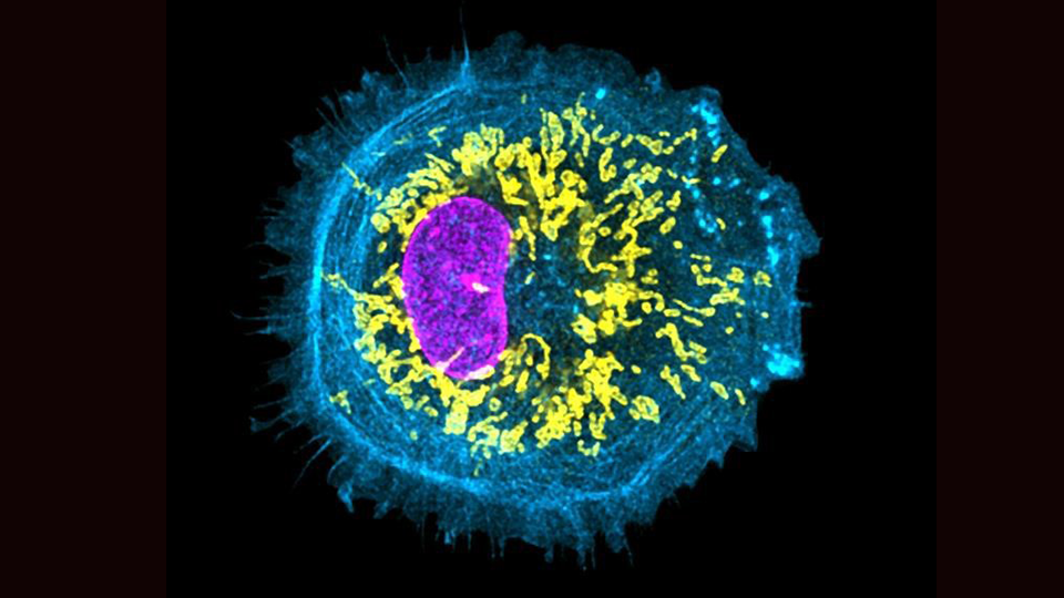 microglia cells 15NOV2023