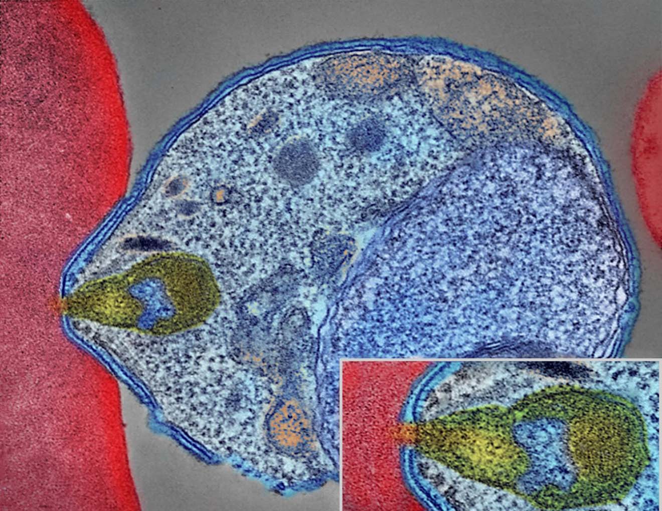 Photo of a colourised electron micrograph showing malaria parasite attaching to a human red blood cell. The inset shows a detail of the attachment point at higher magnification.