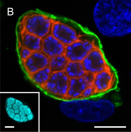 A confocal microscopy image of liver stage of malaria parasite. The inset shows parasite cytoplasm