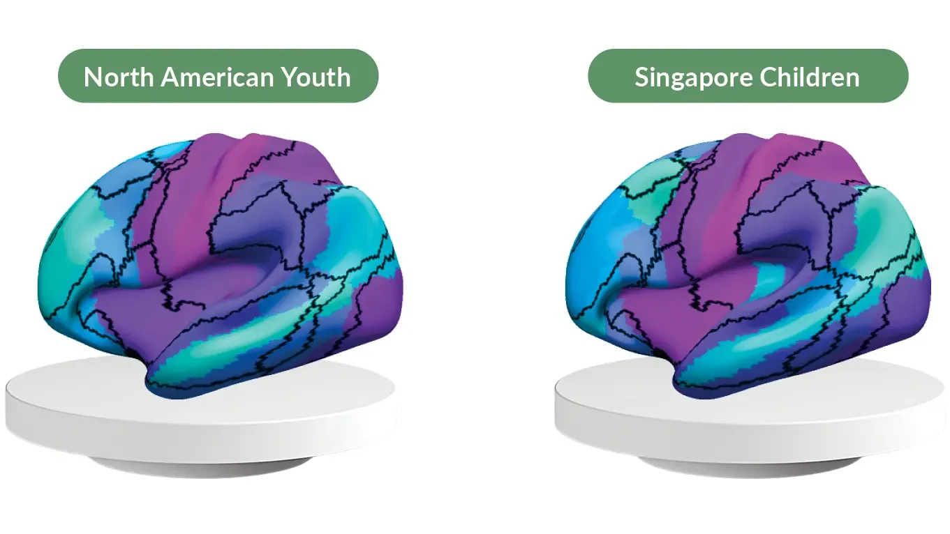 Computer images of MRI brain scans. Left: North American Youth brain. Right: Singapore Children.