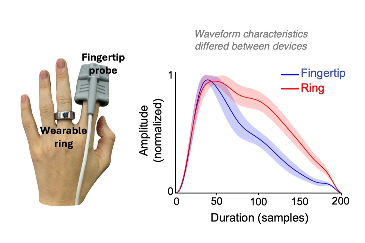 Thumbnail PPG based vascular age assessment image_png